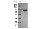 Recombinant Human F13a/Factor XIIIa Protein (His Tag)