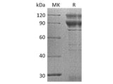 Recombinant Human Coagulation Factor X/F10 Protein (Fc Tag)