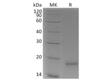 Recombinant Human CLDN18.1 /CLDN18 Protein (His Tag)