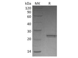 Recombinant Human CNTF Protein (Active)