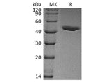 Recombinant Human CHI3L1/YKL40 Protein (His Tag)