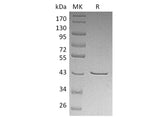 Recombinant Human CHI3L2/YKL-39 Protein (His Tag)