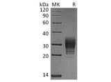 Recombinant Human CREG/CREG1 Protein (His Tag)