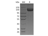 Recombinant Human CDO/CDON Protein (His Tag)