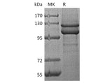 Recombinant Human E-Cadherin/CDH1 Protein (His Tag) Purity >95%