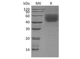 Recombinant Human CD86/B7-2 Protein (Val185Ile, His Tag)(Active)