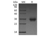 Recombinant Human CD40/TNFRSF5 Protein (His Tag)(Active)