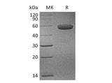 Recombinant Human CD40/TNFRSF5 Protein (mFc Tag)