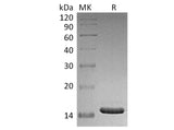 Recombinant Human CD40L/TNFSF5 Protein (E.coli)(Active)