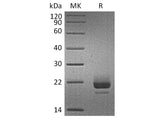 Recombinant Human CD40L/TNFSF5 Protein (His Tag)