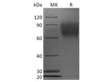 Recombinant Human CD30/TNFRSF8 Protein (His Tag)