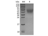 Recombinant Human CD226/DNAM-1 Protein (His Tag)