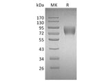 Recombinant Human CD226/DNAM-1 Protein (Fc Tag)(Active)