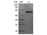 Recombinant Human CD160/BY55 Protein (Fc Tag)