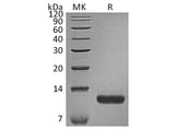 Recombinant Human CCL17/TARC Protein (His Tag)