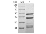 Recombinant Human Cathepsin S/CTSS Protein (His Tag)(Active)