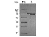 Recombinant Human Catalase/CAT Protein