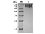 Recombinant Human CEACAM1/CD66a Protein (His Tag)