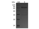 Recombinant Human CAMK1D Protein (GST Tag)