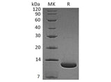 Recombinant Human Complement C5a Protein