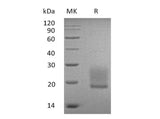 Recombinant Human BTNL9/BTN3 Protein (His Tag)