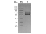 Recombinant Human BTN2A2 Protein (Fc Tag)