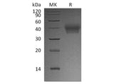 Recombinant Human BTN2A1 Protein (His Tag)