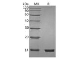 Recombinant Human Beta-2-Microglobulin/B2M Protein (His Tag)