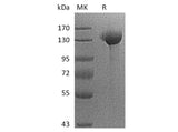 Recombinant Human SIGLEC2/CD22 Protein (Fc Tag)