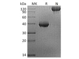 Recombinant Human BCMA/TNFRSF17 Protein (Fc Tag)