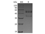 Recombinant Human ANGPTL7 Protein (His Tag)