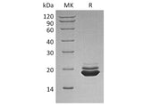 Recombinant Human APLP-1 Protein (aa 42-212, His Tag)