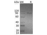 Recombinant Human AMIGO2 Protein (Fc Tag)