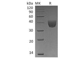 Recombinant Human CD157/BST1 Protein (His Tag)