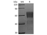 Recombinant Human CD28/TP44 Protein (mFc Tag)