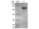 Recombinant Human OX40/TNFRSF4 Protein (mFc Tag)