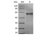 Recombinant Human TIM-3/HAVCR2 Protein (mFc Tag)