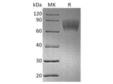 Recombinant Human CD30/TNFRSF8 Protein (His & Avi Tag)