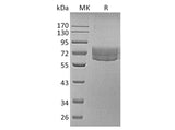 Recombinant Human TIM-3/HAVCR2 Protein (Fc & Avi Tag)