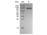 Recombinant Human PD-L1/B7-H1/CD274 Protein (Fc & Avi Tag)