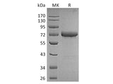 Recombinant Human OX40/TNFRSF4 Protein (Fc & Avi Tag)