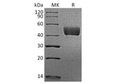 Recombinant Human Mesothelin/MSLN Protein (His & Avi Tag)