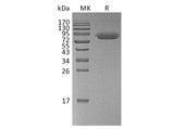 Recombinant Human CD47/IAP Protein (Fc & Avi Tag)