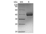 Recombinant Human EpCAM/TROP-1 Protein (His & Avi Tag)