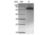 Recombinant Human EGFR/ErbB1 Protein (His & Avi Tag)