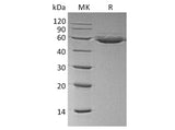 Recombinant Human CTLA4 Protein (Fc & Avi Tag)(Active)