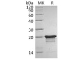 Recombinant Human/Mouse FGF-8b/FGF8B Protein (Active)