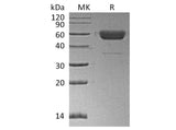 Recombinant Human/Mouse/Rat Irisin/FNDC5 Protein (Fc Tag)