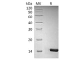 Recombinant Human/Mouse/Rat BDNF Protein (Active)