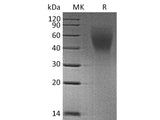 Recombinant Human CA125/MUC16 (C-6His)